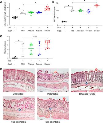 Increase of intestinal bacterial sialidase activity exacerbates acute colitis in mice